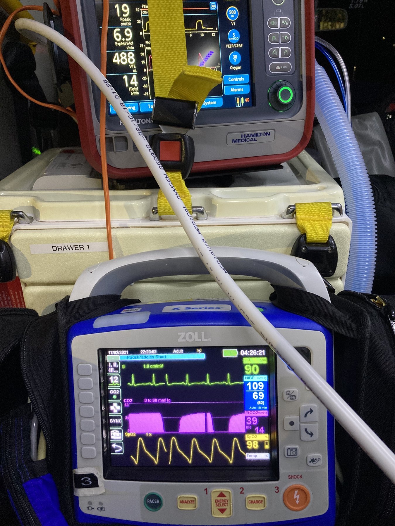 Ambulance monitor and defibrillator equipment showing vital signs.